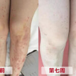 青黛萬用膏