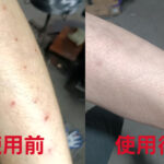 青黛萬用膏
