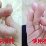 青黛萬用膏
